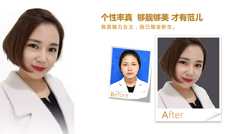 承德美鼻、V脸