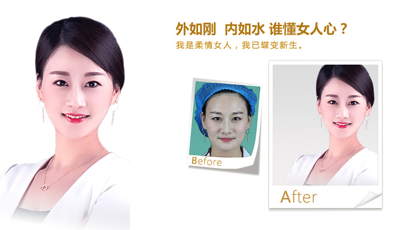 承德V脸、线雕隆鼻